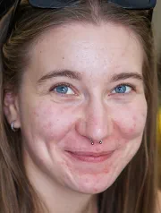 Anetka Krátká